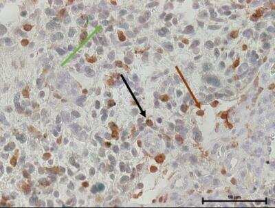 Immunohistochemistry-Paraffin: TOR/mTOR [p Ser2448] Antibody [NB600-607]